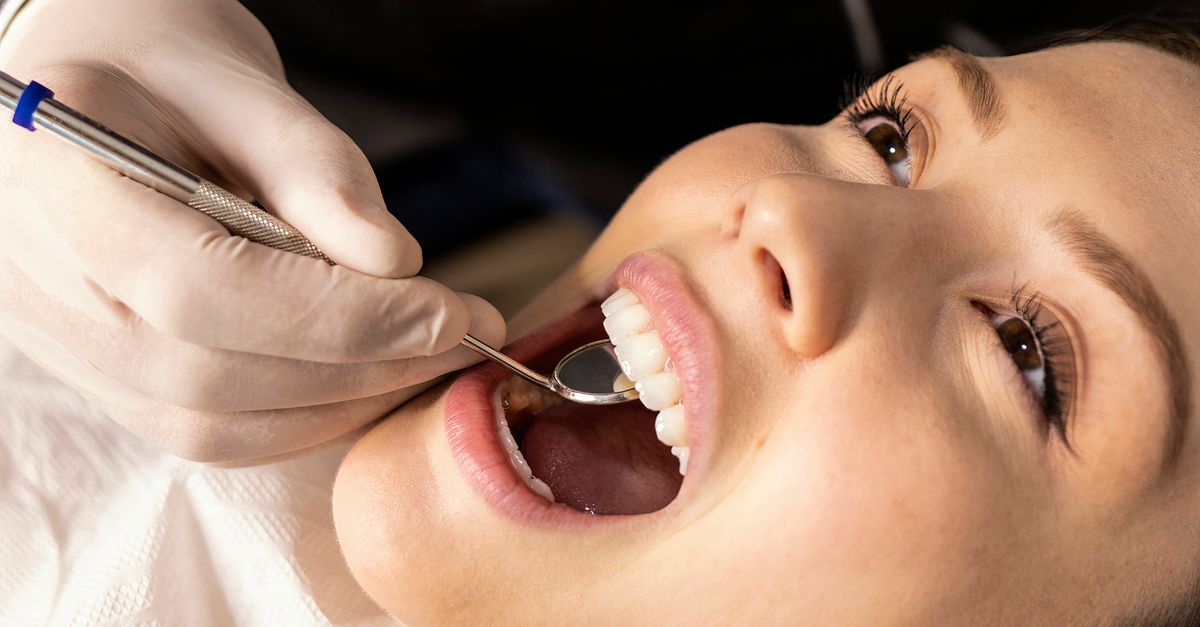 Enhancing Smiles with Professional Teeth Whitening Solutions