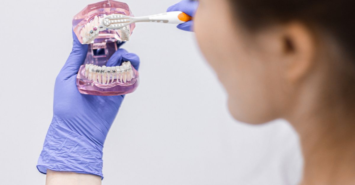 Exploring the Latest Trends in Cosmetic Bonding Techniques